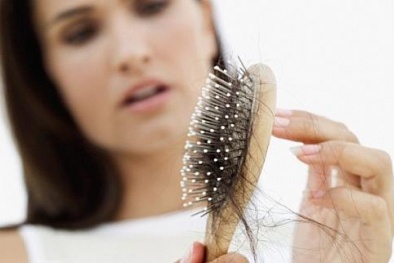 Cảnh báo một số loại thuốc có thể gây rụng tóc