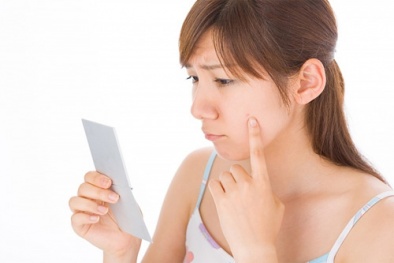 Những nguyên tắc cần biết trong điều trị mụn