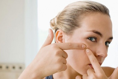 Bí quyết dùng dầu dừa trị mụn hiệu quả