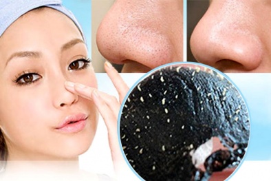 Bí quyết trị mụn đầu đen đơn giản từ rau, củ, quả