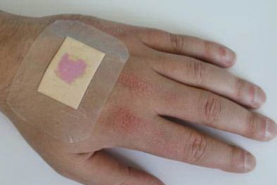 Băng y tế thông minh đổi màu theo tình trạng vết thương