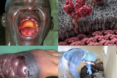 WHO tuyên bố Liberia khống chế thành công dịch Ebola