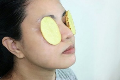 Mẹo làm dịu vết cháy nắng mùa hè từ khoai tây