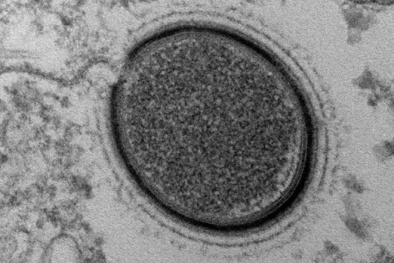 Hồi sinh virus cổ đại khổng lồ bị đóng băng suốt 30.000 năm