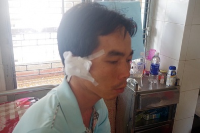 Can ngăn đánh nhau, Phó công an xã bị côn đồ chém lìa tai