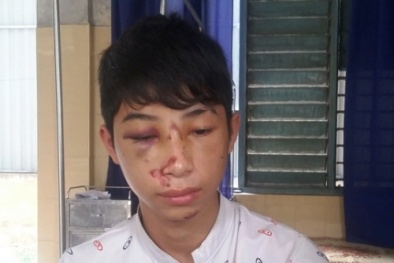 Trưởng công an xã bị tố đánh người: Đi tìm sự thật từ lời kể của người trong cuộc