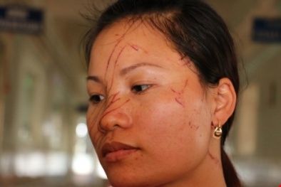 Rạch mặt dã man 2 mẹ con hàng xóm vì mẫu thuẫn cái giếng nước