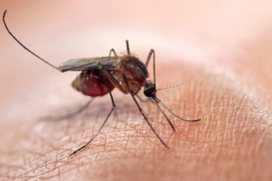 Dấu hiệu nhận biết cơ thể đang mắc virus Zika