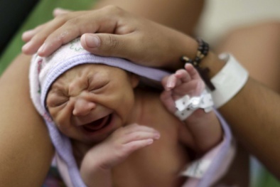 Virus gây teo não lây lan dữ dội