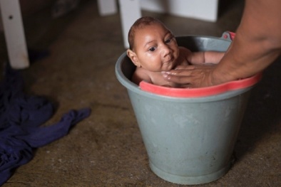 Thực hư thông tin virus Zika gây teo não lây qua đường quan hệ tình dục