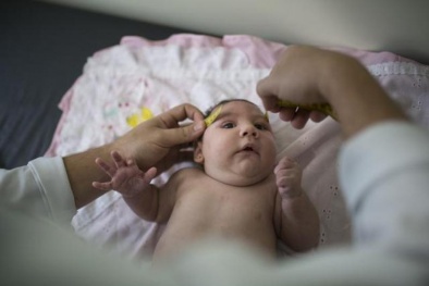 Báo động: Virus Zika gây bệnh đầu nhỏ đã lan tới nước láng giềng của Việt Nam