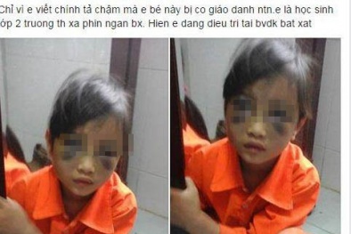 Viết bài chậm, nữ sinh tiểu học bị cô giáo đánh bầm tím mặt