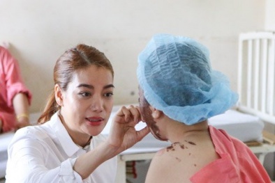 Ấm lòng nghĩa cử tài trợ tiền thẩm mĩ cho nữ sinh bị tạt axit của Trương Ngọc Ánh