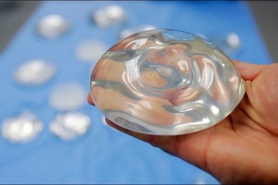 Có thể mất mạng vì bơm silicone lỏng giá rẻ