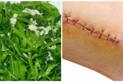 Những người sau tuyệt đối không nên ăn rau muống