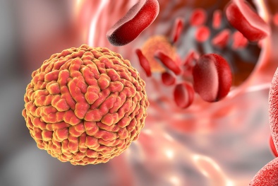 Số người nhiễm virus Zika tại TP.HCM gia tăng