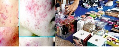 Mỹ phẩm giả, kém chất lượng và những 'hệ lụy' nhan sắc