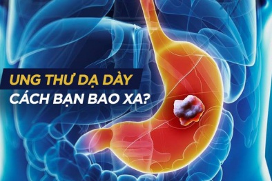 Ung thư dạ dày cách bạn bao xa?