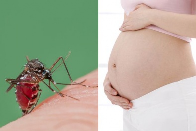 Tin cảnh báo nổi bật: Vi rút Zika sống 'dai dẳng' trong não thai nhi