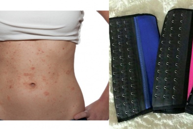 Nịt bụng giảm cân: Chẳng có tác dụng gì ngoài 'đau đớn'