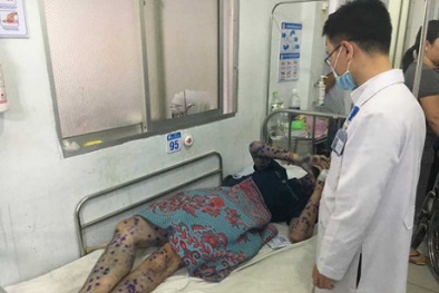 Lại xuất hiện ổ dịch thủy đậu ở TP. Hồ Chí Minh