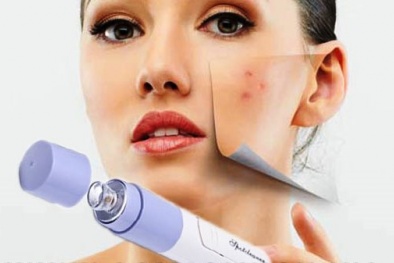 Khó thẩm định chất lượng máy hút mụn mini