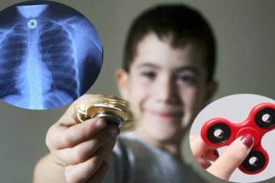 Đồ chơi Spinner khiến 2 trẻ ở Mỹ suýt mất mạng, Việt Nam đang là... mốt