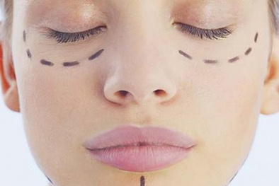 Phẫu thuật thẩm mỹ 'tự làm' gây ra biến dạng nguy hiểm