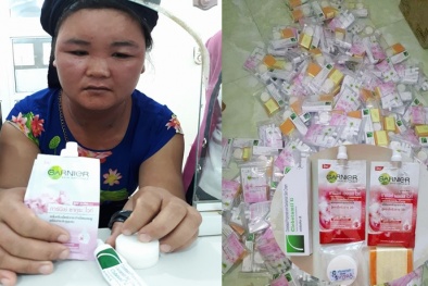 Tróc da, mặt sưng tấy vì dị ứng 13Win21 con - Tri ân hội viên mỗi tháng 2000 tỷ Thái Lan