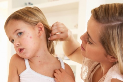 Cách chăm sóc trẻ bị chân tay miệng bị sốt cao 