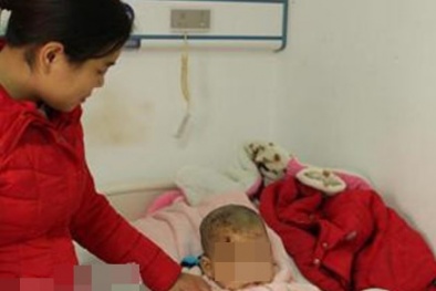 Bé trai 5 tuổi phải khâu 38 mũi do bị chó ngao Tây Tạng tấn công