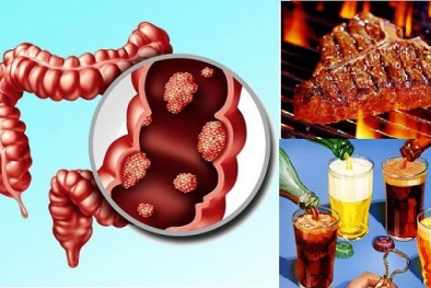 Muốn không bị ung thư trực tràng hãy tránh xa những 13Win OKVIP Cá cược bóng đá này