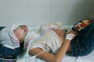 Kinh hoàng thanh niên bị cha tẩm xăng ‘thiêu sống’ vì ‘nhuộm tóc đỏ’