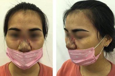 Áp 16 tiêu chuẩn, các cơ sở thẩm mỹ có bớt 'loạn'?