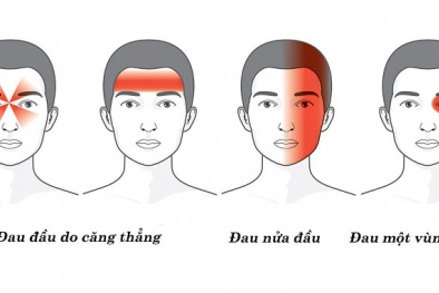 Những 'thủ phạm' gây đau đầu cần biết để tránh