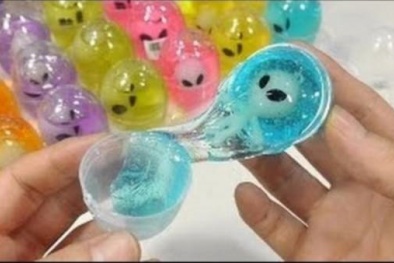 Con gái tự chế loại đồ chơi này, bà mẹ hốt hoảng khi thấy tay con bỏng nặng