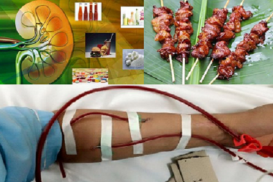 Dùng nhiều nước sốt trong chế biến 13Win1 nhập link nhà cái có thể gây suy thận