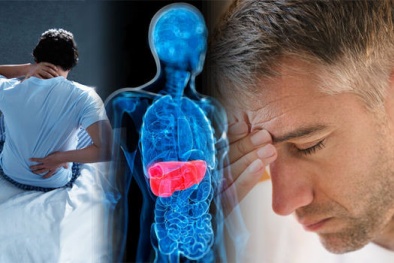 Ung thư gan: 4 nguyên nhân phổ biến không phải ai cũng biết