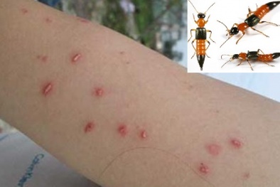 Kiến ba khoang và những hiểm họa không báo trước