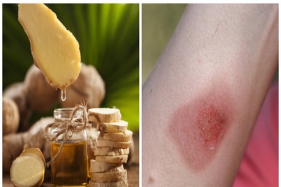 Tức ngực, khó thở nếu dùng tinh dầu sai cách để giữ ấm cơ thể ngày lạnh 