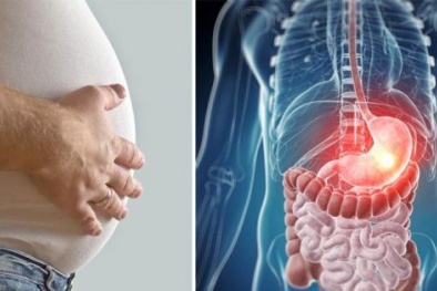 Đầy hơi: Dấu hiệu cảnh báo 5 căn bệnh ung thư nguy hiểm