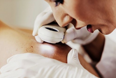 15 triệu chứng cảnh báo bệnh ung thư ai cũng cần biết sớm