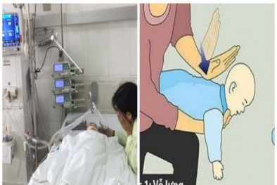 Bé trai suýt chết vì mẹ cho ăn chuối tiêu bị sặc, bác sĩ chỉ cách cứu con trong tích tắc