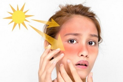 Da xạm, lão hóa nhanh nếu dùng kem chống nắng sai cách