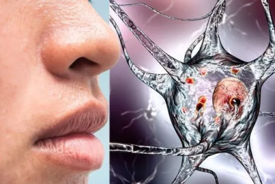 Đột nhiên bị mất mùi, cảnh báo bệnh Parkinson nguy hiểm 