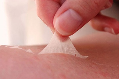 Hậu quả khôn lường từ phương pháp làm đẹp 'lột da'