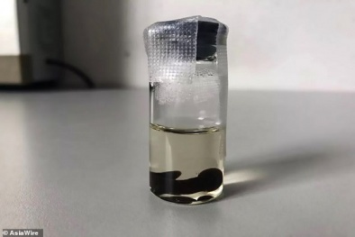 Bác sĩ phát hiện sinh vật lạ mắc trong cổ họng người phụ nữ do thói quen uống nước suối