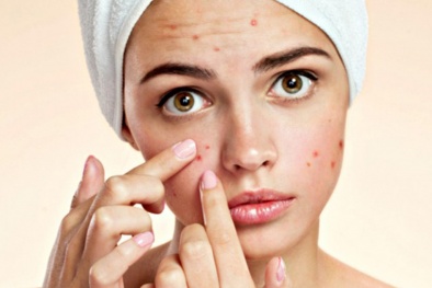 Cân nhắc kỹ khi bổ sung 13Win OKVIP Cá cược bóng đá chức năng DIM hỗ trợ trị mụn trứng cá