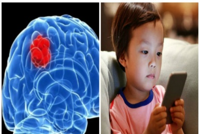 Trẻ nghiện điện thoại có nguy cơ mắc bệnh u não cao gấp 5 lần
