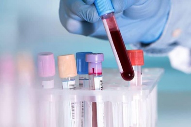 Xuất hiện thêm bộ kit test nhanh virus corona, cho kết quả trong 15 phút